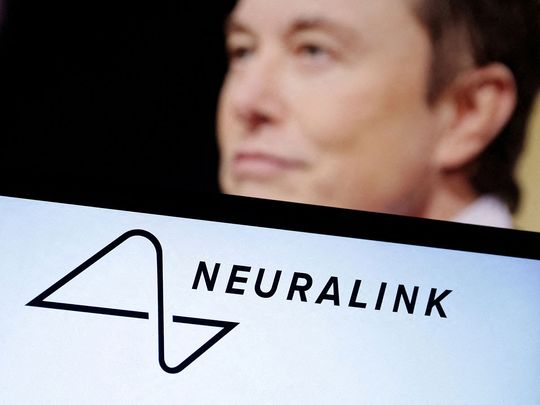 20240130 neuralink